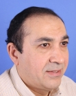 Before Hair Transplant&nbsp;Front